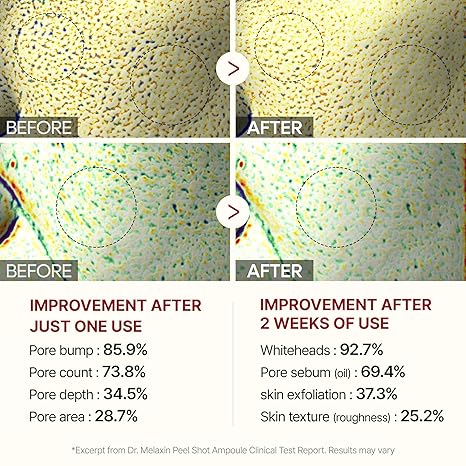 (Genuine Guarantee)Peel Shot Glow Rice Ampoule Duo - Serums for Brightening, Exfoliating, and Moisturizing - Suitable for All Skin Types